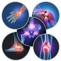 Arthritis pain relief kenya, artritis joint pain treatment, arthritis cure, arthritis management