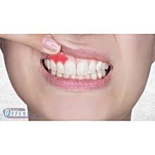 Dental Care Products In Kenya,Teeth Whiteners In Kenya Healthy Teeth, Teeth Health, Best Mouth Washes, White Teeth, Teeth Protection