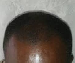 Longjack XXXL Sexual Health Benefits Longjack XXXL in Kenya , Mayahn Anti Balding Cream