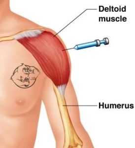 testosterone-cypionate-deltoid-shoulder-injection, Testosterone Cypionate 250Mg Injection